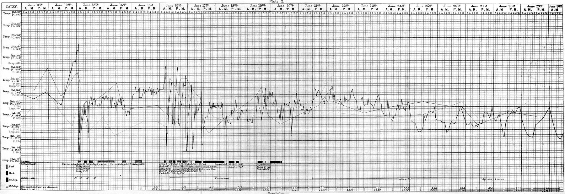 A printed clinical chart from June 1871 with temperature, pulse and respiration traced across twenty days of gridded paper.