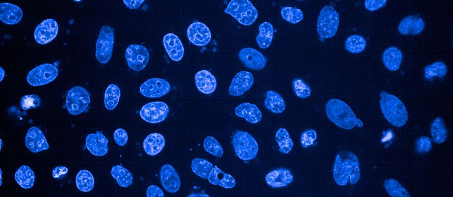 DAPI-stained nuclei of HeLa cells