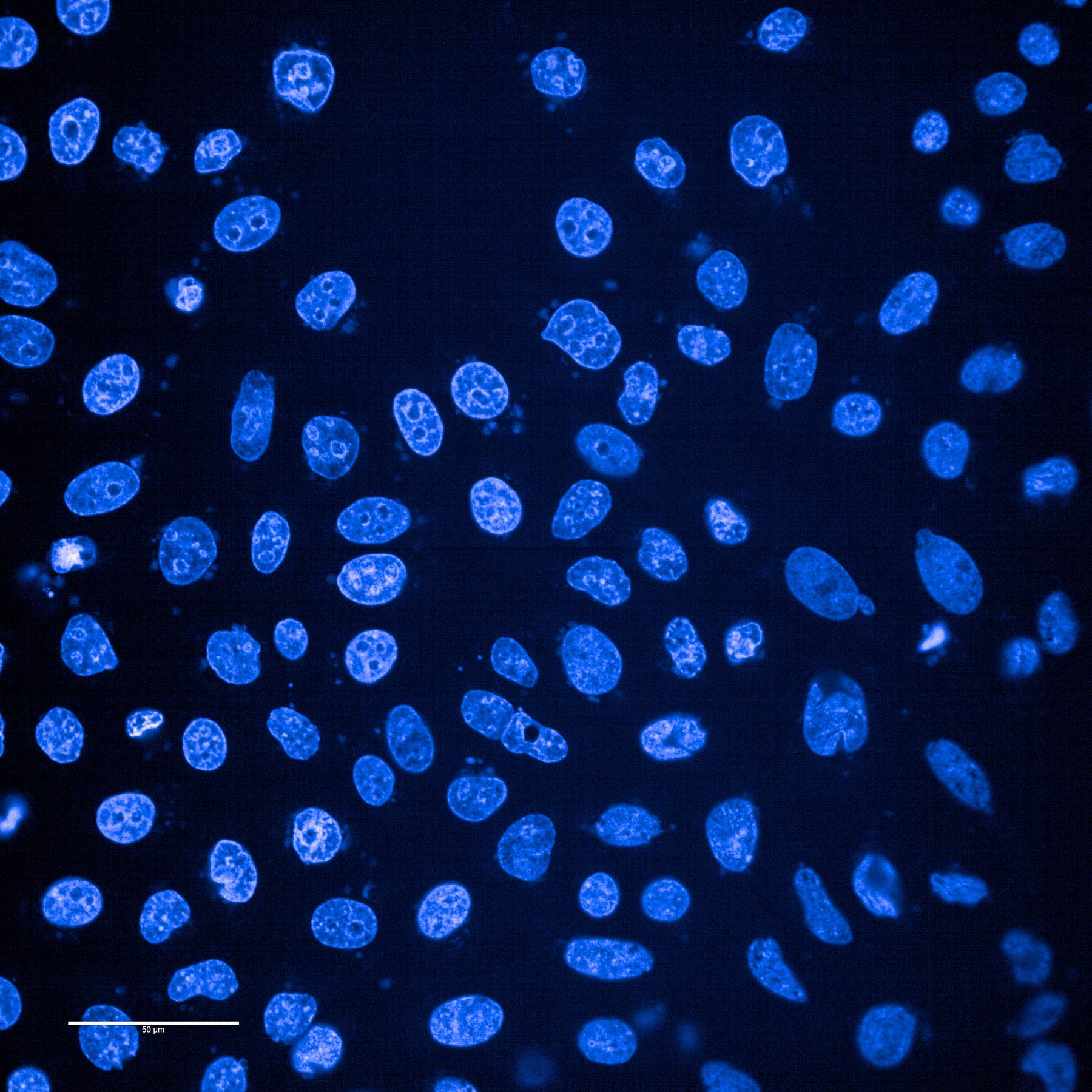 Dozens of blue-stained cell nuclei of different shapes and brightness scattered across a black field.